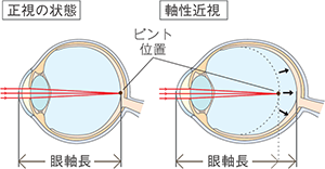 眼球のイメージ