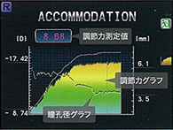 AIアコモドメーター機能